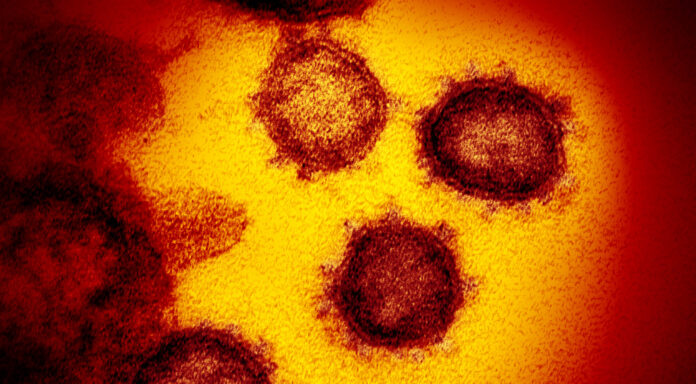 Coronavirus. (Creative Commons / NIAID)